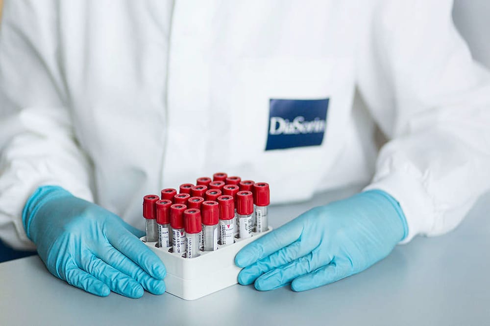 MeMed Diagnostics (Haïfa) associée à Dia Sorin (Italie).