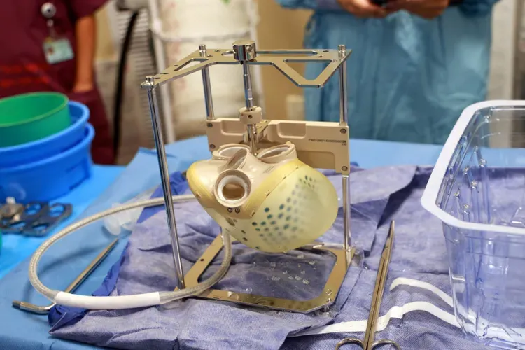 RADIO J. Coopération médicale France-Israël. 1ère transplantation d’un cœur artificiel de nouvelle génération CARMAT.