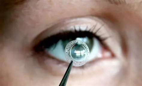 La cornée artificielle de CorNeat Vision restaure une vision parfaite de 20/20 chez un patient aveugle atteint de zona.