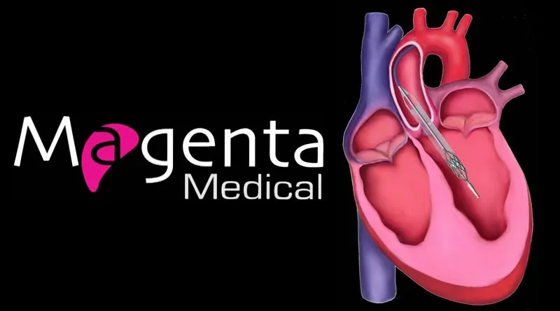 Magenta Medical obtient 105 millions de dollars US pour la plus petite pompe cardiaque au monde.