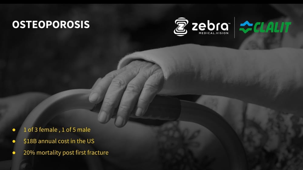 Santé : Les israéliens Zebra Medical Vision et Clalit vont déployer l’imagerie IA à grande échelle.