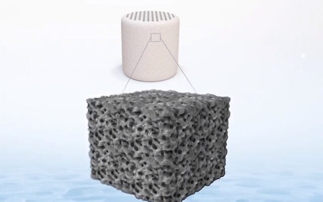 Implant de cartilage de genou. La société israélienne CartiHeal rachetée par Smith & Nephew.