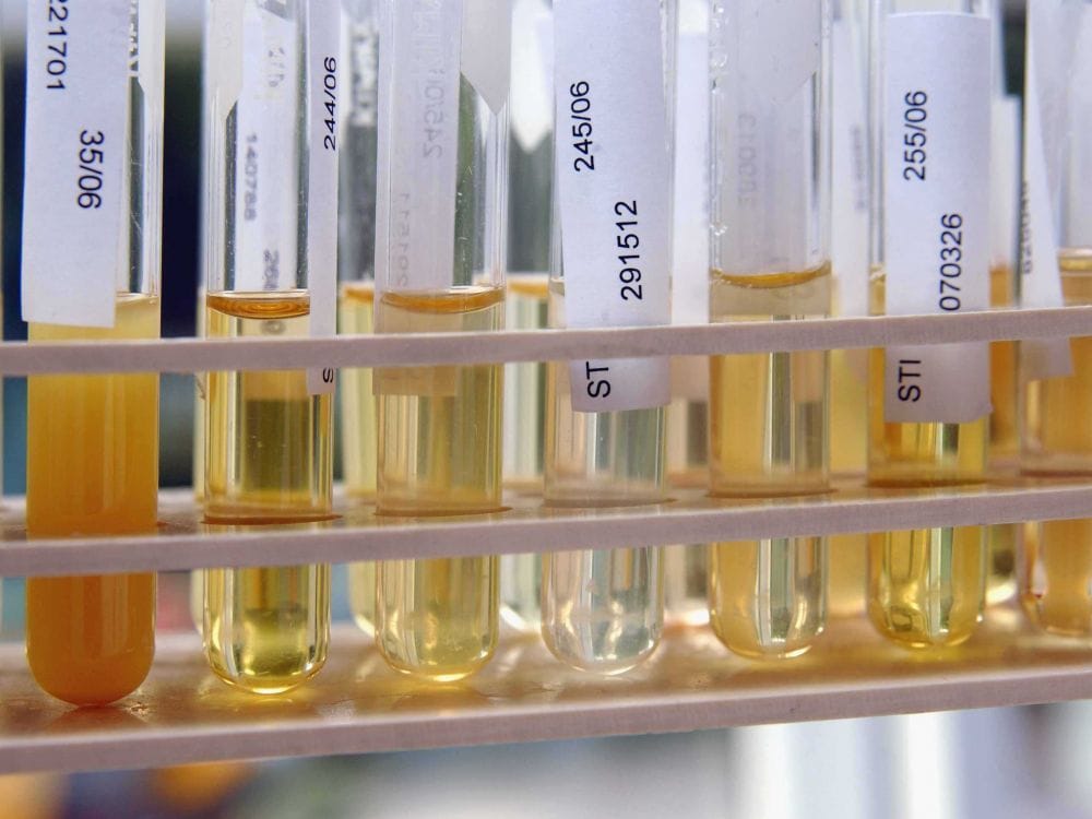 Analyse d’urine. Healthy.io (Tel-Aviv), une appli approuvée par la FDA.