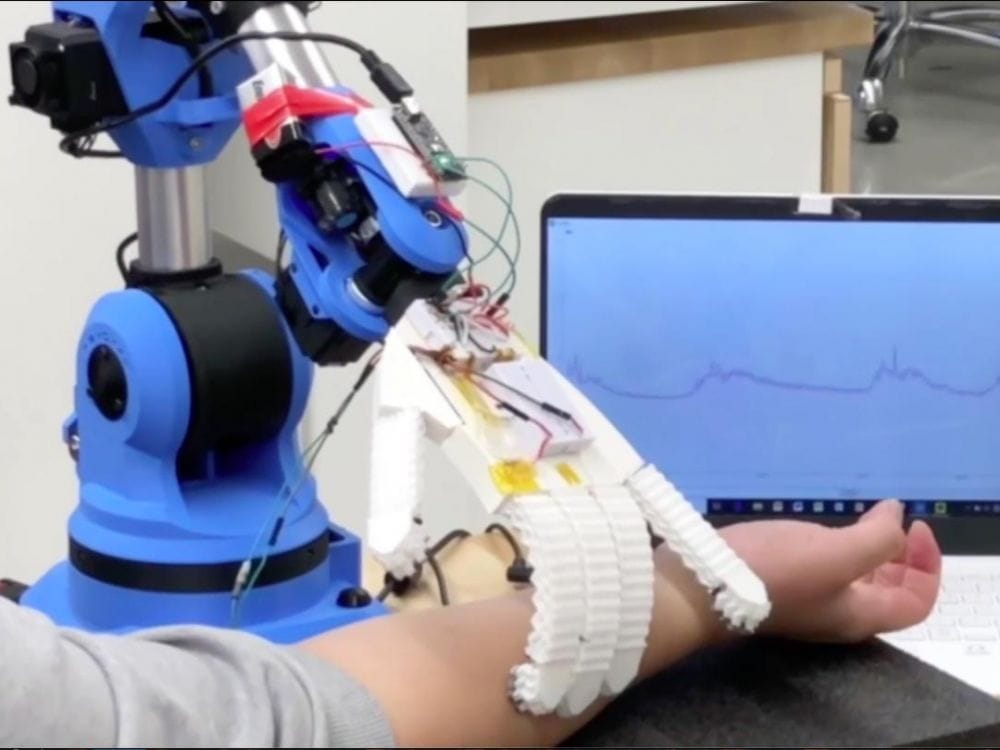 Canada & Israël. Une main robotique pour ausculter les patients.