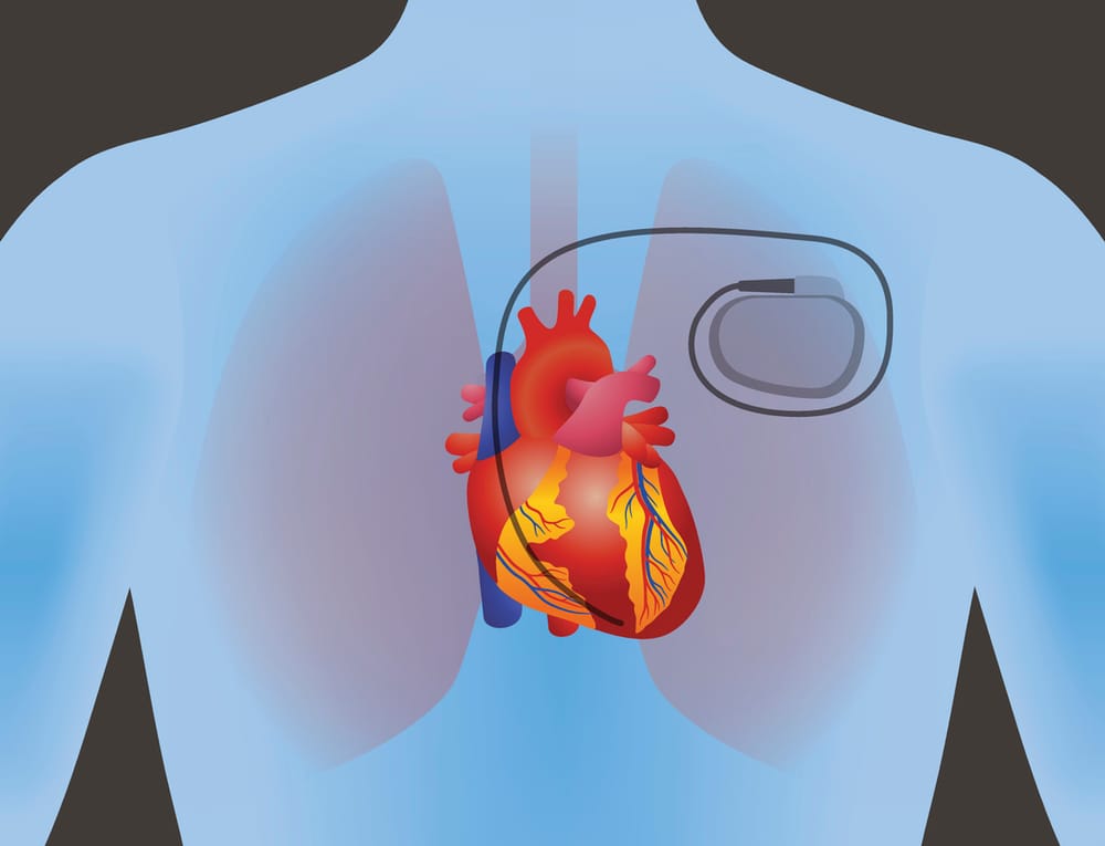 Israël Innovation. L’énergie corporelle pour alimenter les pacemakers.