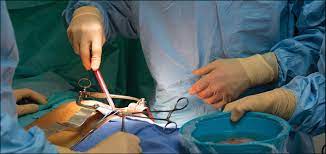Accord israélo-suédois. Transplantations rénales en Europe Centrale et Israël.