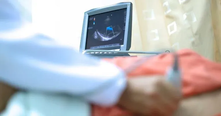 UltraSight et le Centre médical Sheba permettent des images cardiaques précises et de qualité diagnostique grâce aux ultrasons.