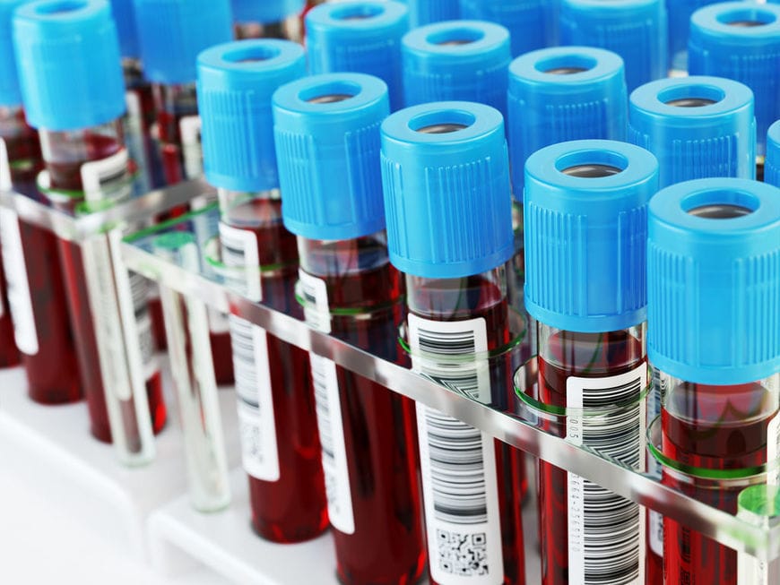 Asthme. CytoReason (Israël) collabore avec le fabricant français Sanofi.