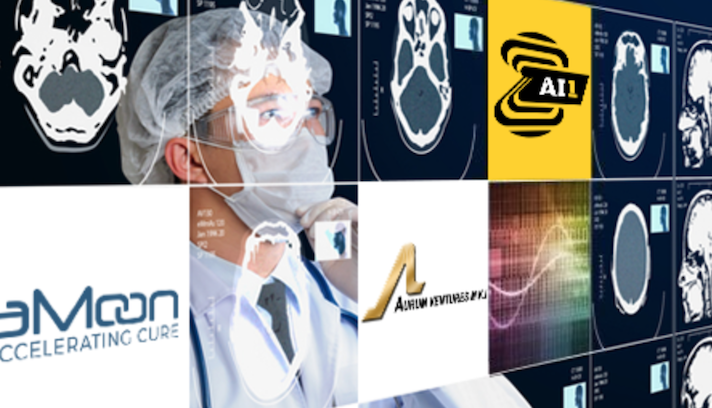 Storm ID (Royaume-Uni) et Zebra Medical Vision (Israël) : une nouvelle solution révolutionnaire de prévention de l’ostéoporose basée sur l’IA.