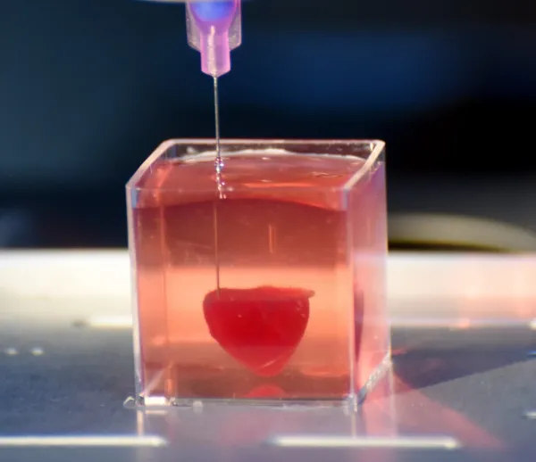 Radio J. Tsahal soigne ses blessés grâce à des solutions très innovantes. Un prototype de coeur humain imprimé en 3D. Nanox, technologie d’imagerie médicale.