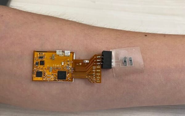 Nouveau patch cutané israélien capable de détecter la tuberculose.