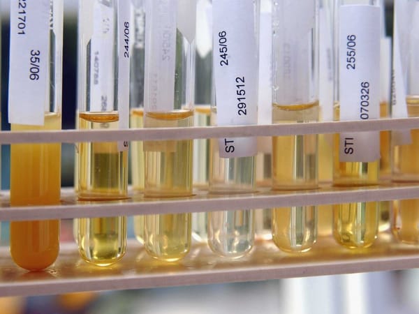 Analyse d’urine. Healthy.io (Tel-Aviv), une appli approuvée par la FDA.