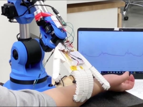 Canada & Israël. Une main robotique pour ausculter les patients.