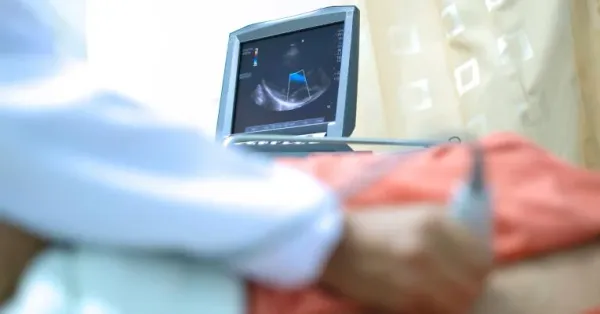 UltraSight et le Centre médical Sheba permettent des images cardiaques précises et de qualité diagnostique grâce aux ultrasons.