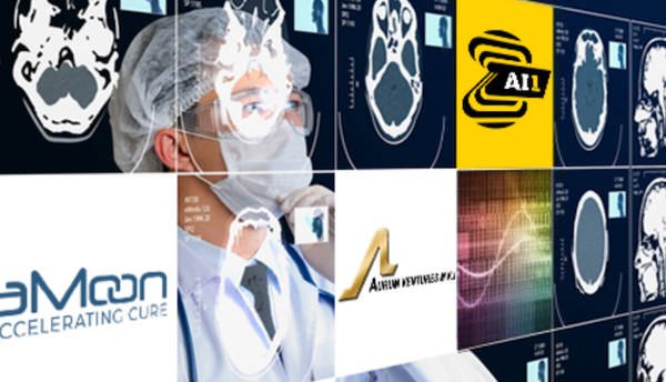 Storm ID (Royaume-Uni) et Zebra Medical Vision (Israël) : une nouvelle solution révolutionnaire de prévention de l’ostéoporose basée sur l’IA.